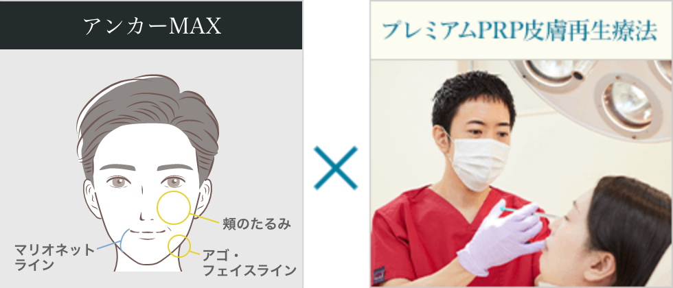 アンカーMAX×プレミアムPRP皮膚再生療法