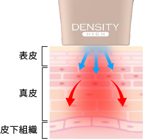 高出力のRF（高周波）エネルギー