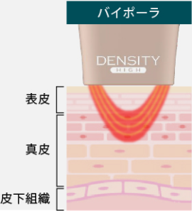 バイポーラRF