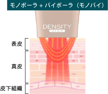 モノポーラとバイポーラによる「モノバイ技術」