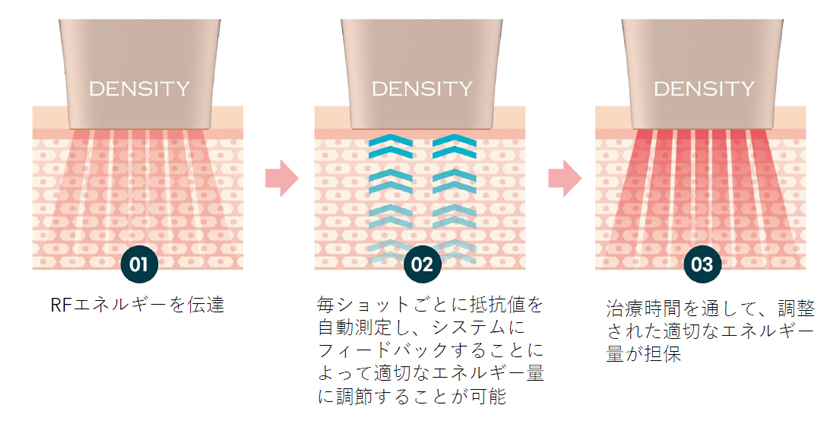 リアルタイムインピーダンスチェック機構