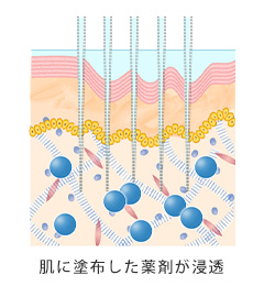 薬剤浸透イメージ