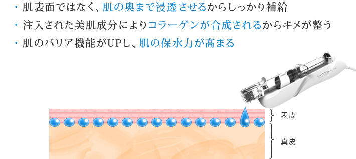 水光注射が有効な理由