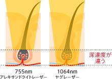 エリートiQとは