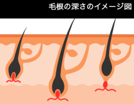 毛根の深さのイメージ図