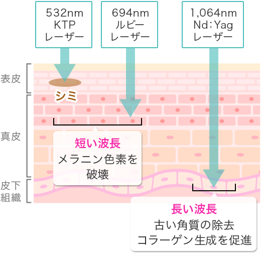 照射できる波長の種類