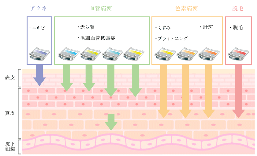 自分仕様のスキンケア治療